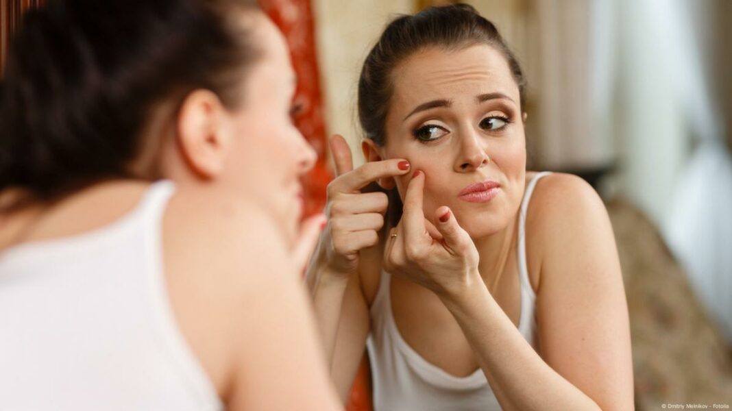 البثور العميقة تهدّد البشرة وتؤرق النساء