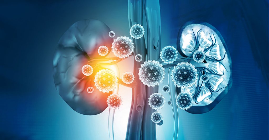 مسكنات الألم